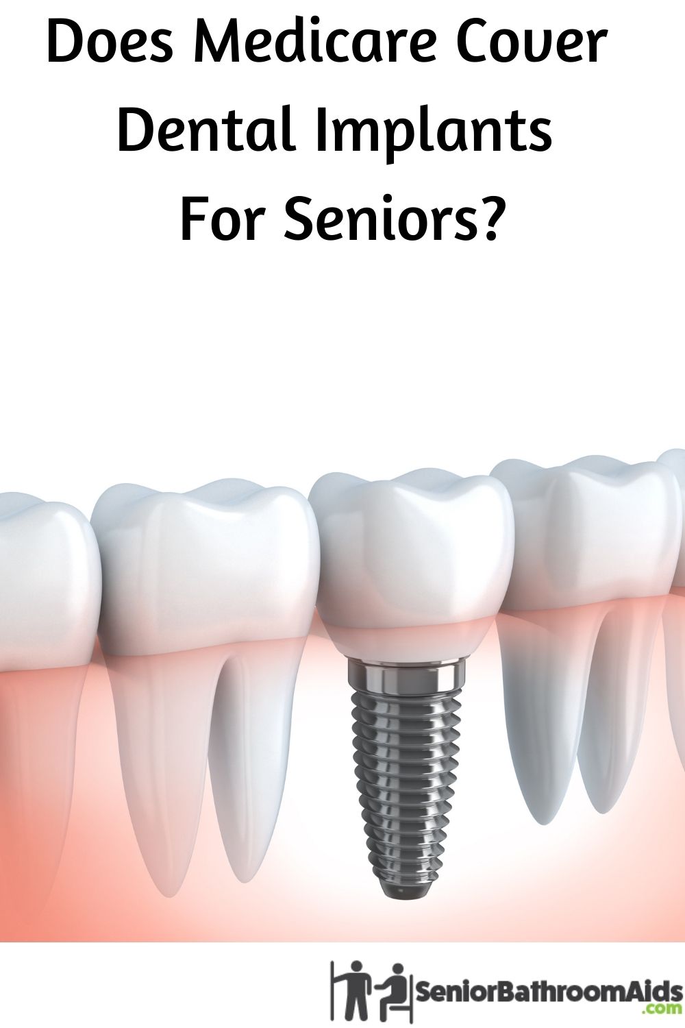 Does Medicare Cover Dental Implants 2021