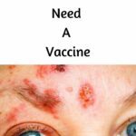 shingles Vaccine