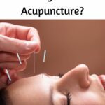 Does Medicare Cover Acupuncture?