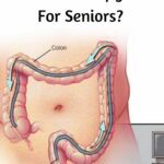 Does Medicare Cover Colonoscopy For Seniors?